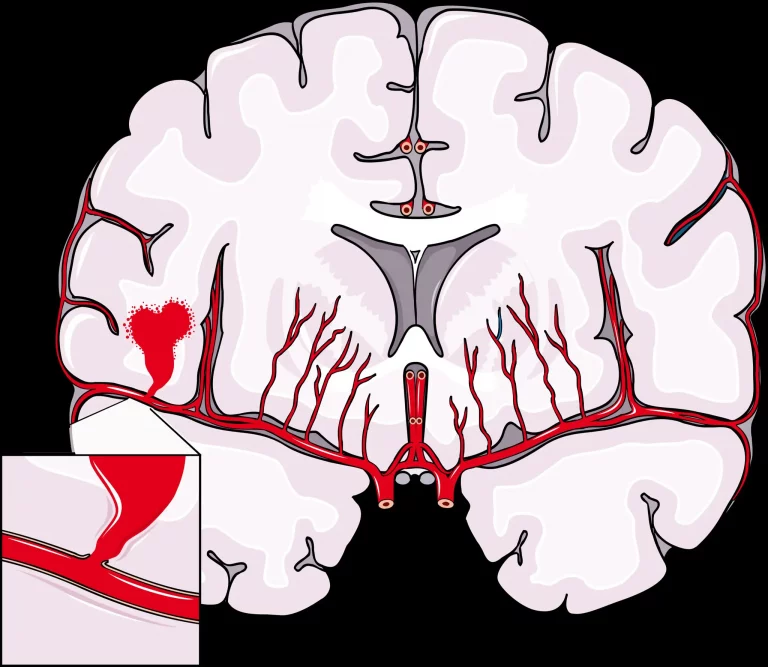 Le nanbudo plus qu’une discipline sportive, un enjeu sanitaire dans un pays où, survient un AVC toutes les 5 heures
